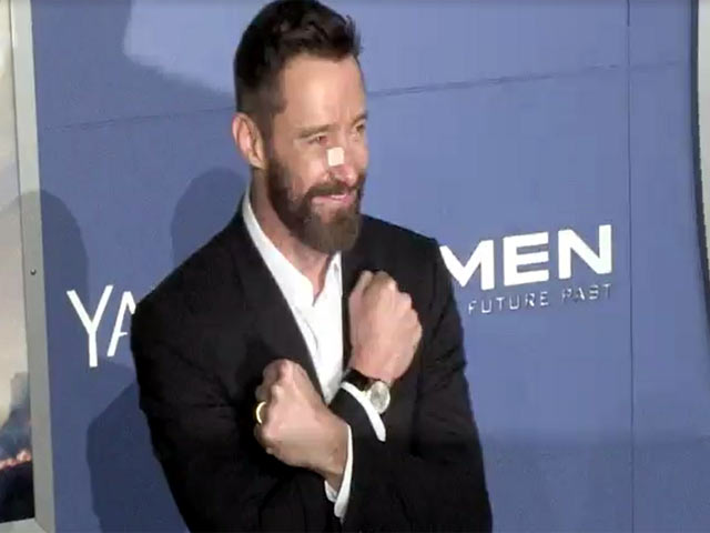 Hugh Jackman Sports Bandaged Nose At 'X-Men: Days Of Future Past' World Premiere - Part 1
