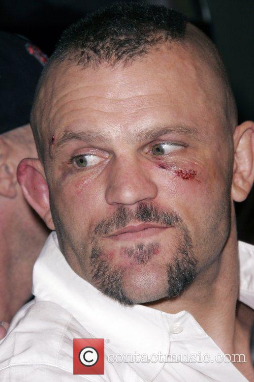 Chuck Liddell