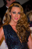 Michelle Heaton Damages Nerves In Scalding Accident